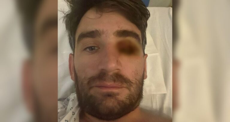 Hombre pierde un ojo tras explosión de pirotecnia en fiesta de Año Nuevo