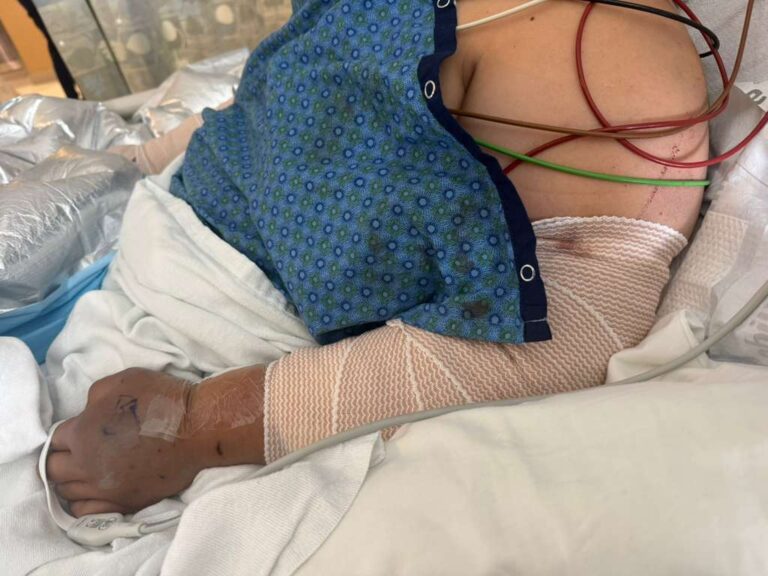 Devastador ataque de perros en Aurora deja a mujer en estado crítico