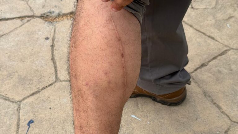 Migrantes deportados por Reynosa viven una pesadilla de tortura